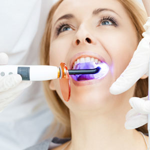 Patient whitening teeth at dentist with modern equipment