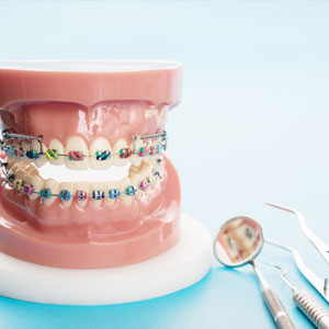 Orthodontic model and dentist tools