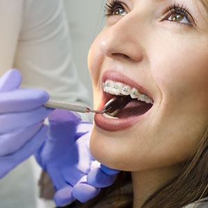 Closeup of beautiful girl on dental braces check up