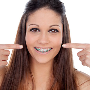 Buffalo braces to fix your teeth