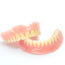 Dentures for a new, natural-looking smile in Buffalo – the “secret” is in a precision fit and quality design!