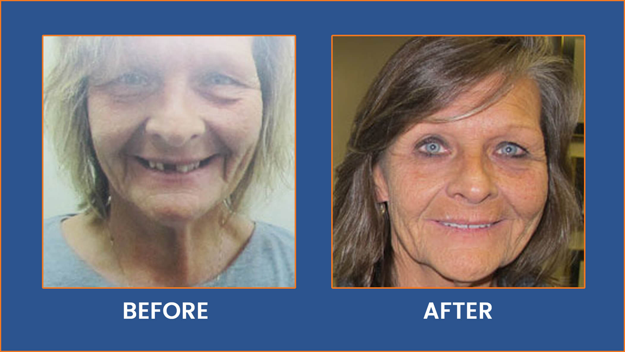 Smile Gallery Dentist Buffalo NY, Cosmetic Dentistry, (716) 2207635