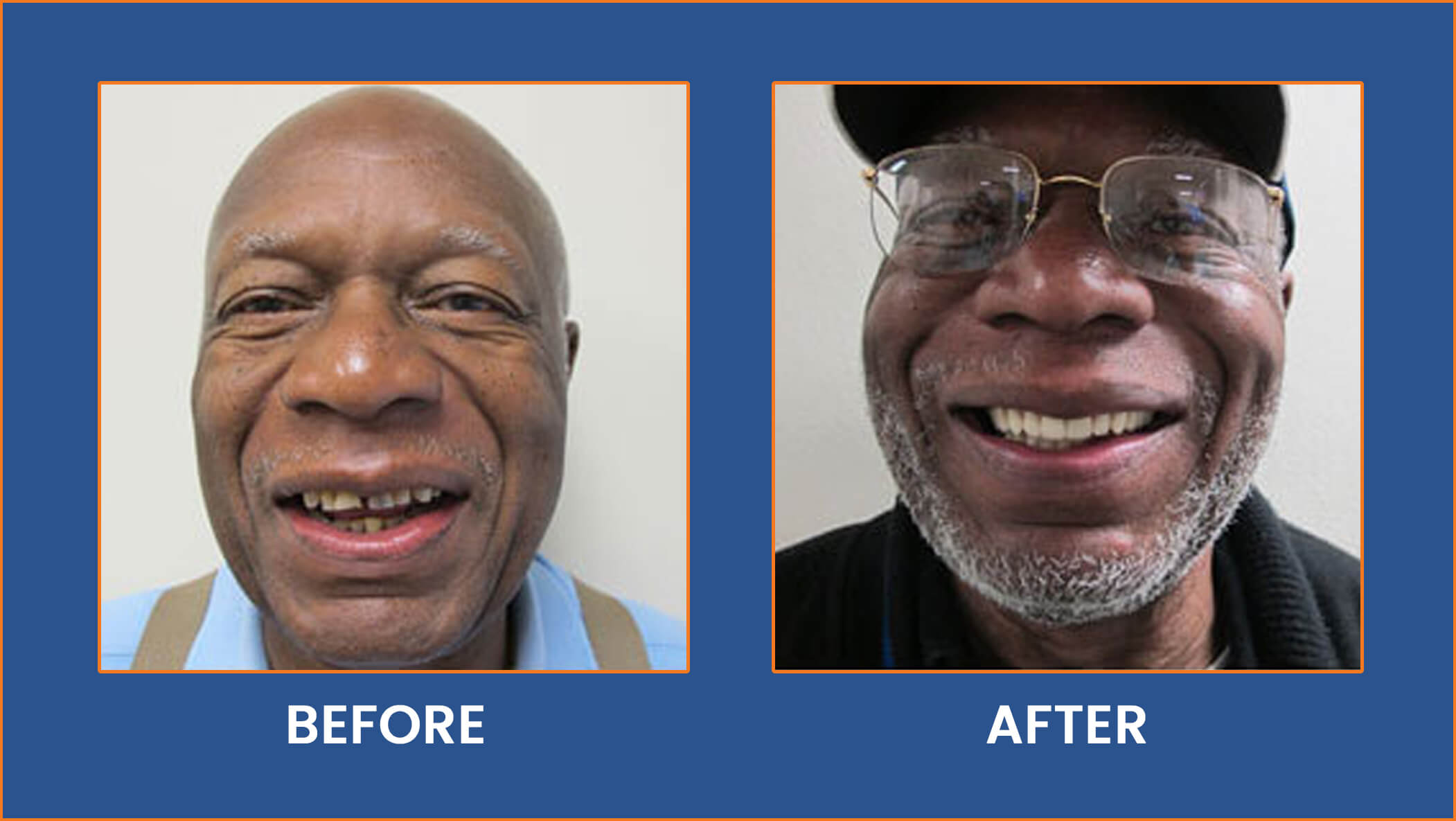 Dental Implants Buffalo, NY