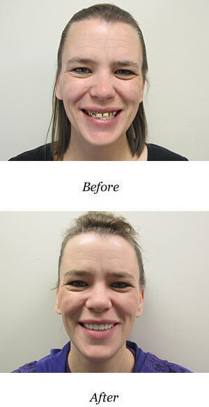 before-after-smile-gallery-image-111
