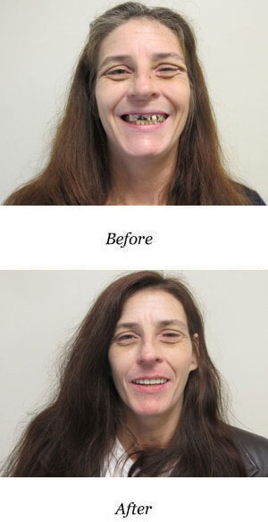 before-after-smile-gallery-image-116