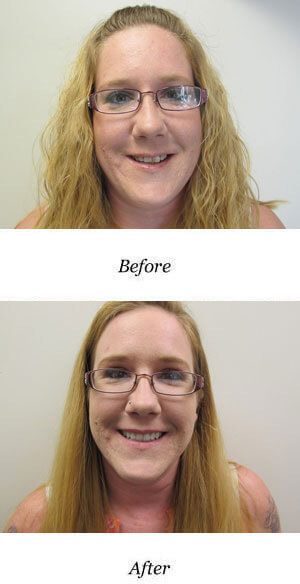 before-after-smile-gallery-image-12