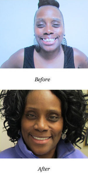 before-after-smile-gallery-image-132