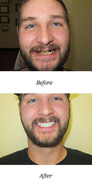 Before and after at smile center