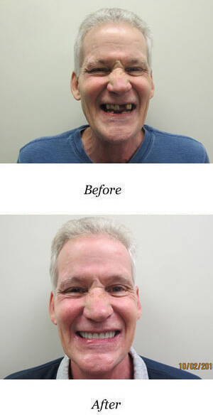before-after-smile-gallery-image-37