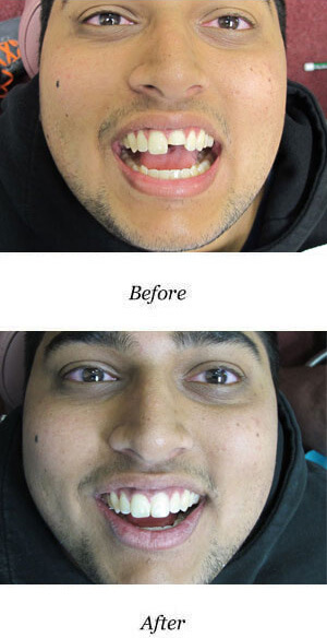 before-after-smile-gallery-image-54