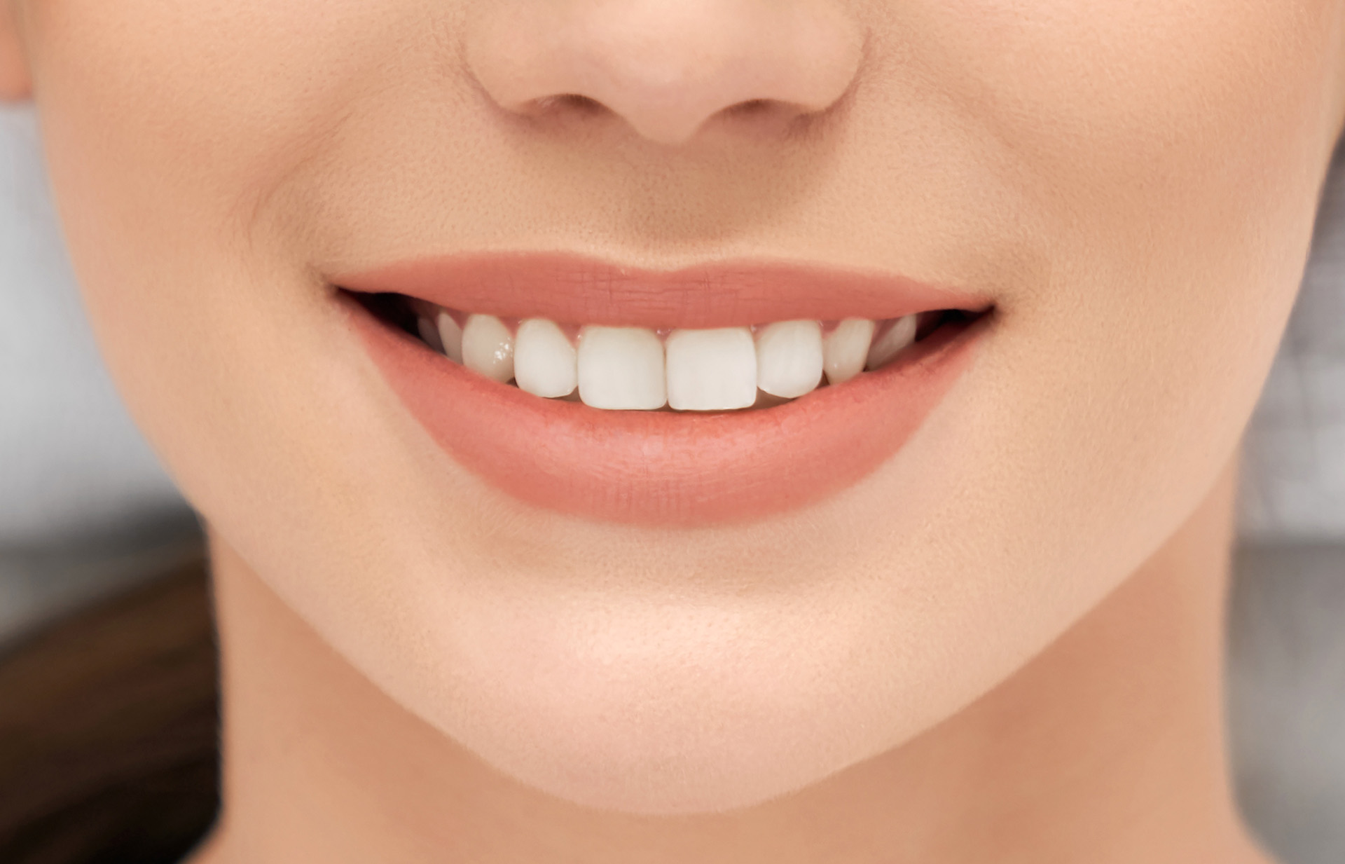 How Much Does It Cost to Whiten Teeth? Comparing DIY vs Professional Methods