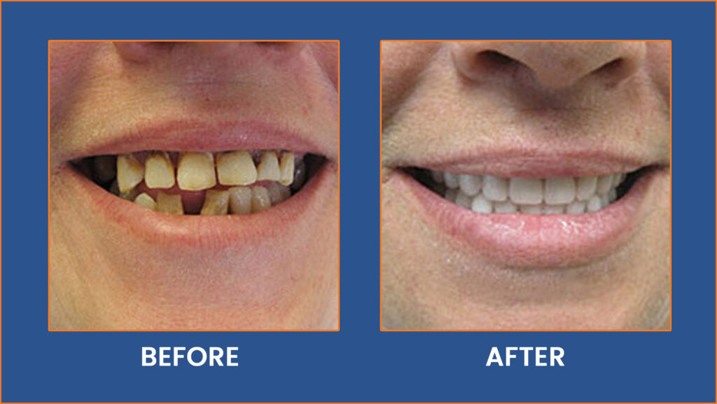 Dental-1