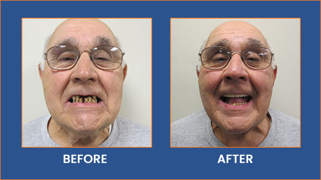 Dental-11