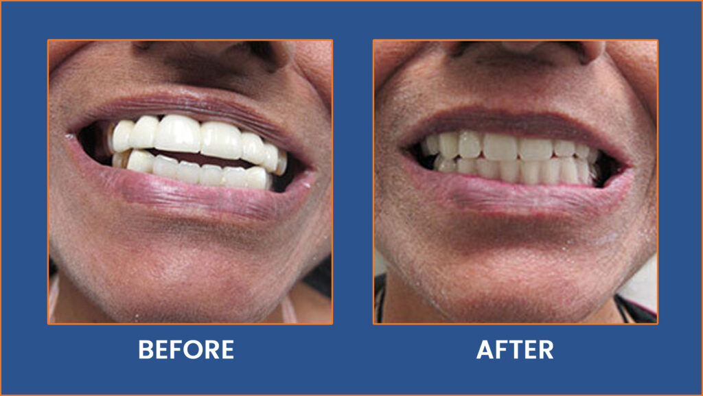 Dental-12