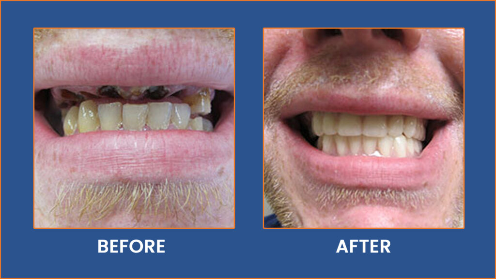 Dental-15