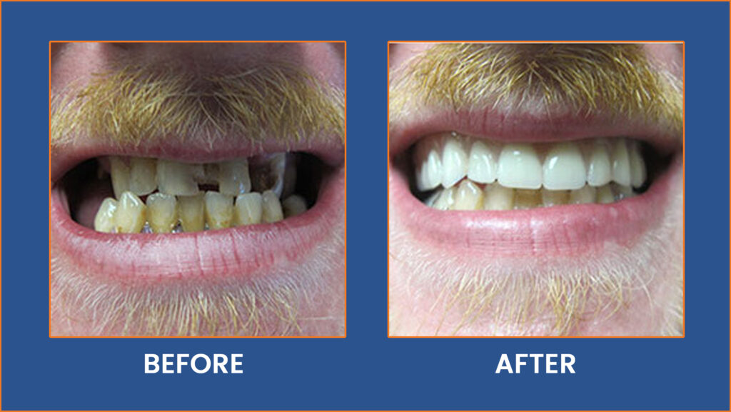 Dental-16
