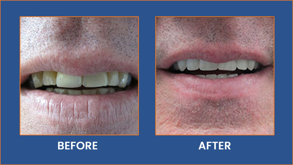 Dental-19