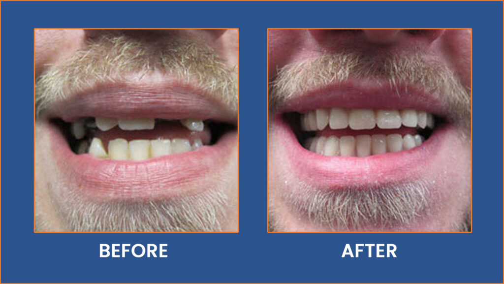 Dental-2