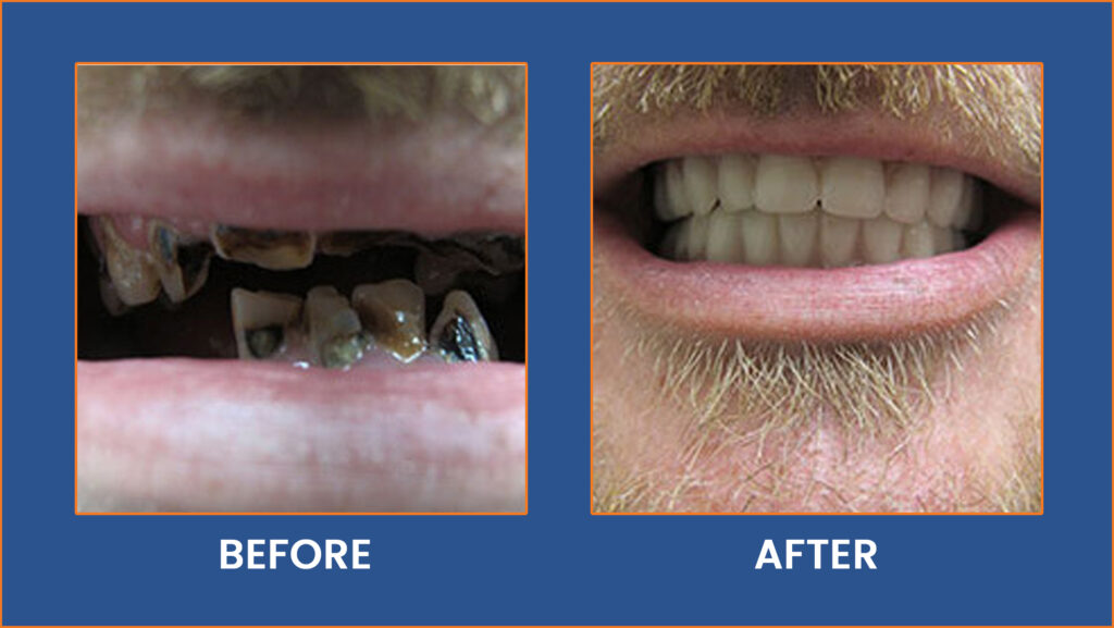 Dental-22