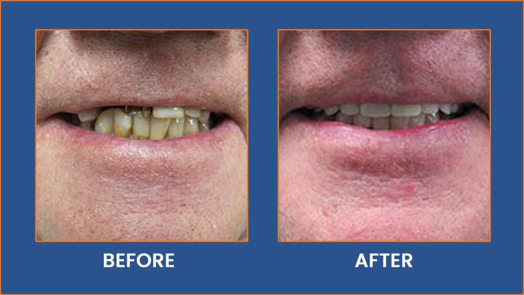 Dental-24