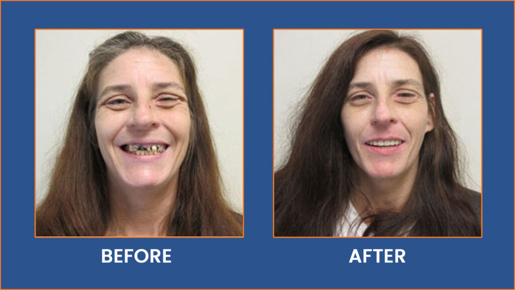 Dental-4