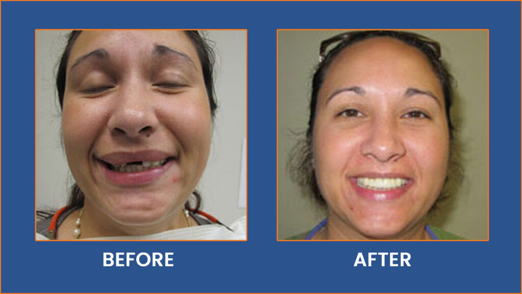 Dental-7