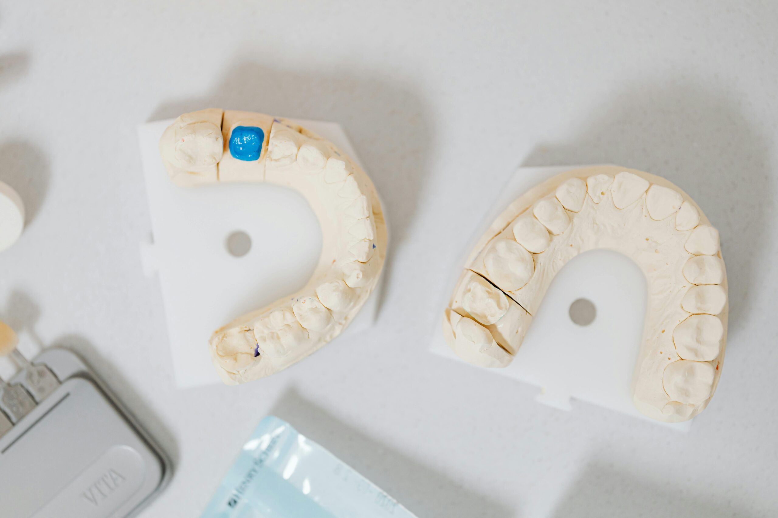 dental fillings